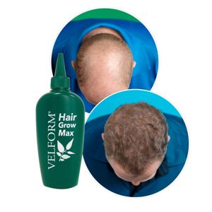Podpora rastu vlasov Velform Hair Grow Max
